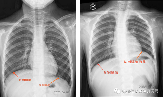 徐州仁慈醫(yī)院